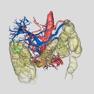 動脈・門脈・腸管を統合した三次元画像（縦回転）（クリックで動画再生, 550kB）
